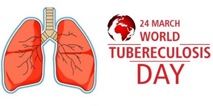 24 БЕРЕЗНЯ – ВСЕСВІТНІЙ ДЕНЬ БОРОТЬБИ З ТУБЕРКУЛЬОЗОМ